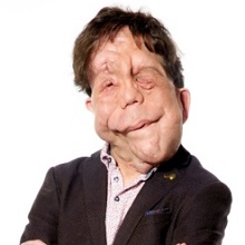 adam-pearson
